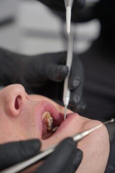 Тимчасова коронка/вінір (клінічна) (встановлення), фото 2