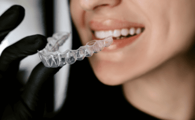 Елайнери, фото 2