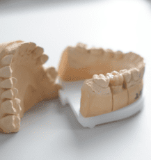 Коронка з діоксиду цирконію, фото 1